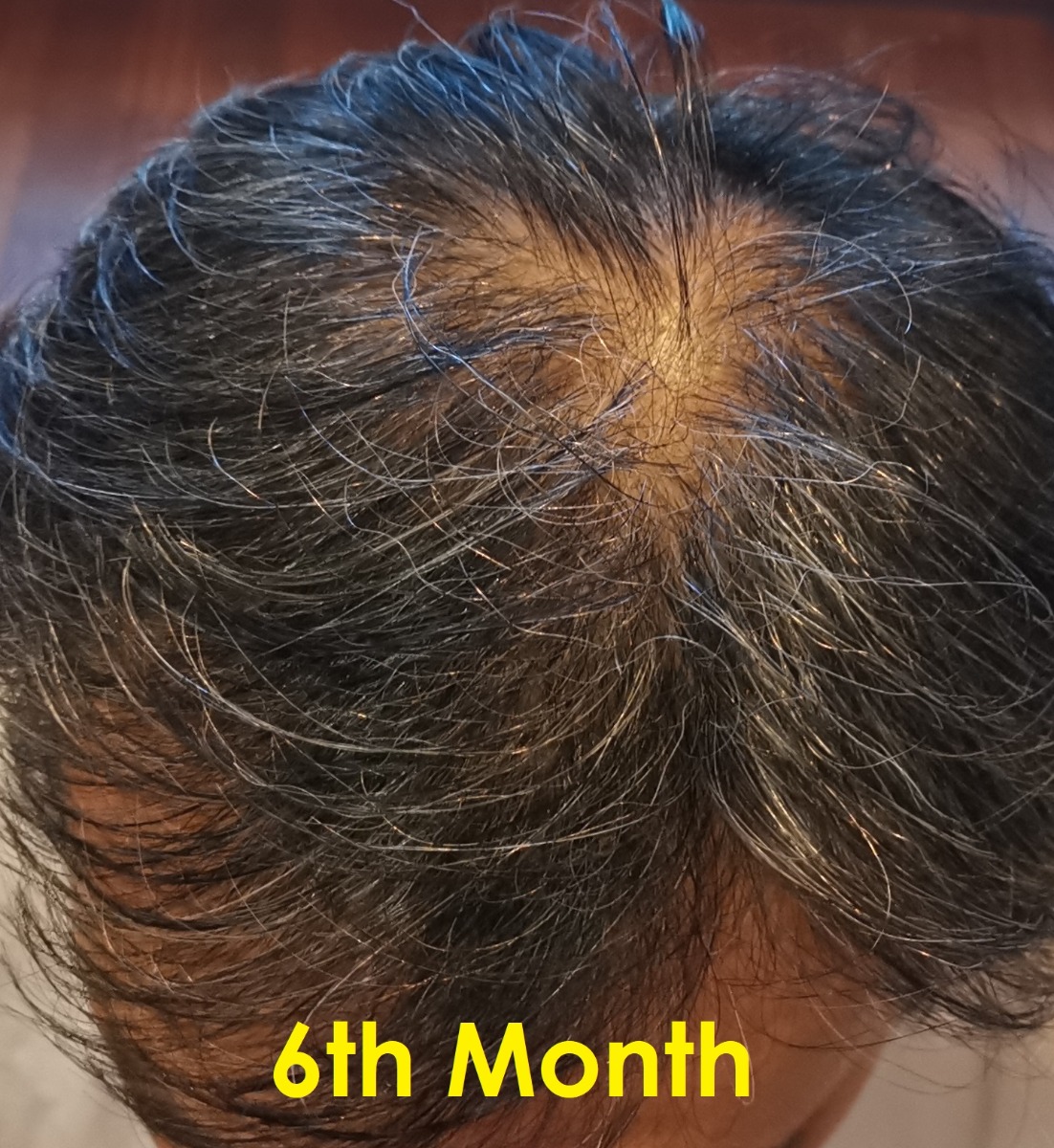 RS Hair 6th Mth A