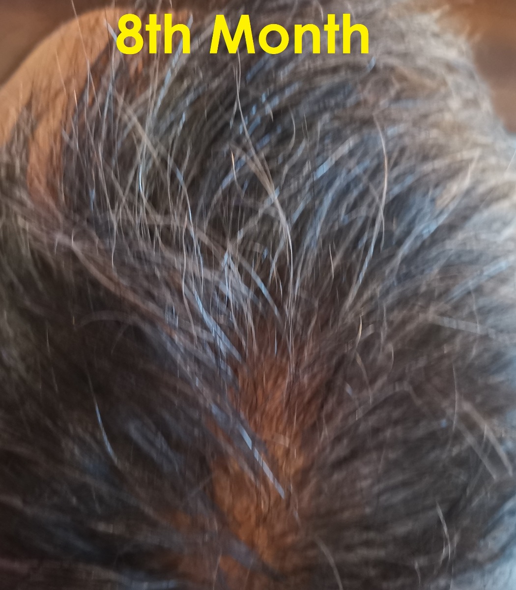 RS Hair 8th Mth